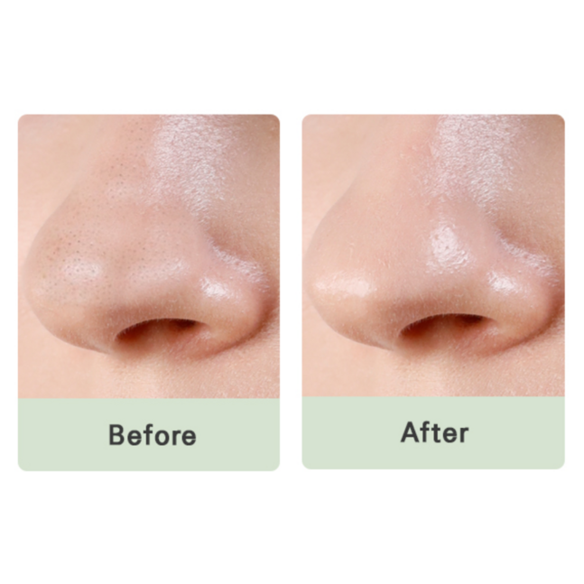 PORE FRESH NOSE PACK
