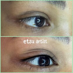 Салстын контер шивээс