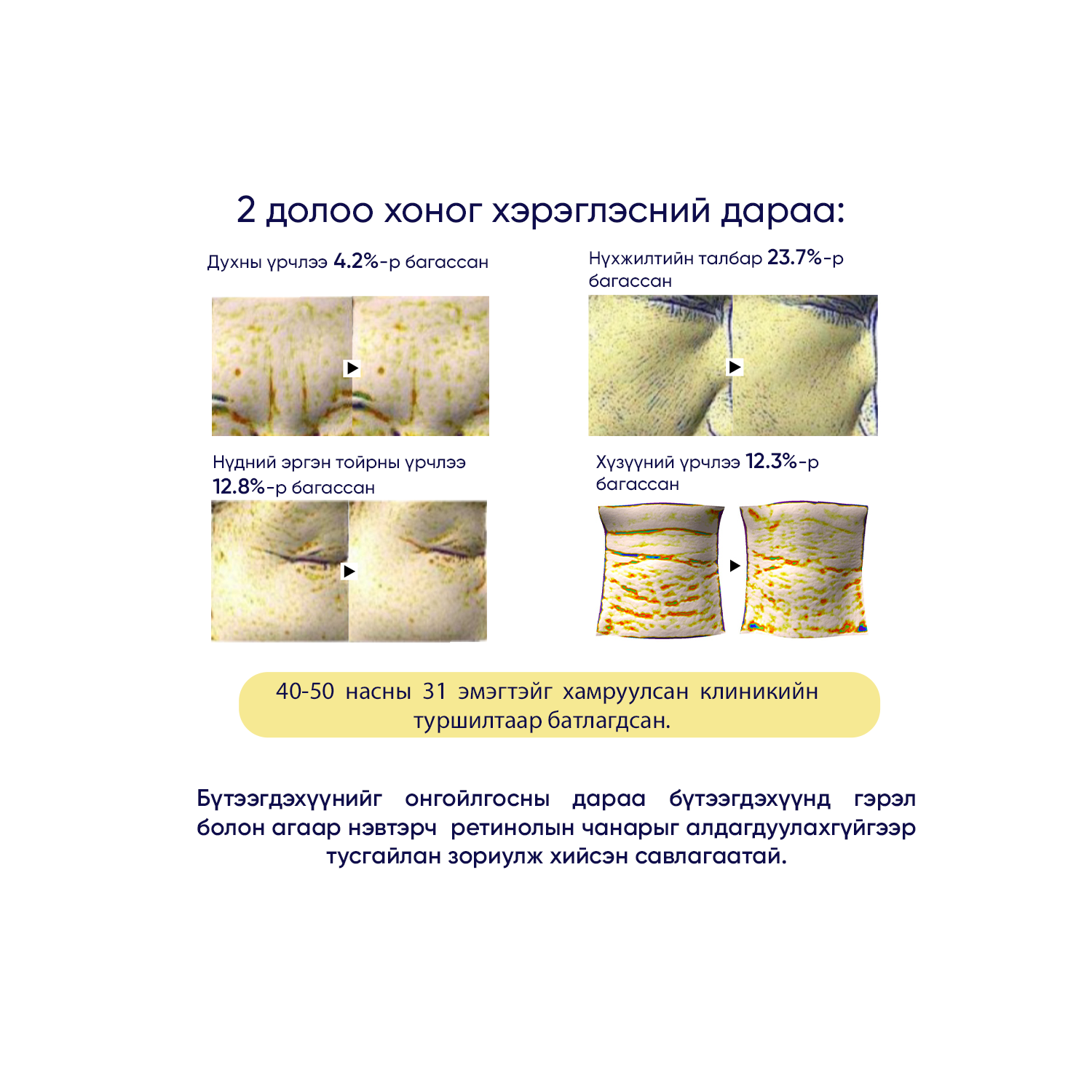 IOPE RETINOL EXPERT 0.1%