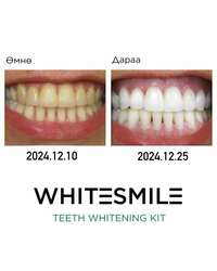 Whitesmile teeth whitening kit + refill gel (шүд цайруулах багц + цэнэглэгч гель)