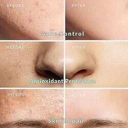 Jkona volcanic ash pore mud mask нүхжилт маск