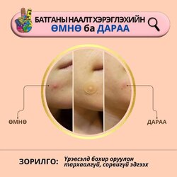 Peace батганы наалт