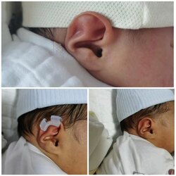 Чихний хэлбэр засагч 