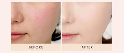Ender cat - foundation skin concealer 
