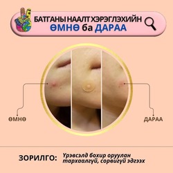 Peace батганы наалт 