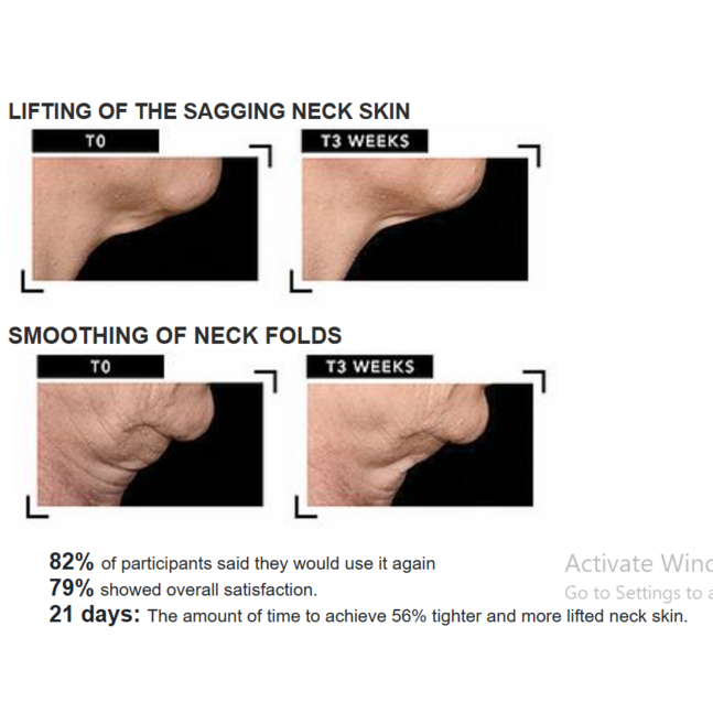PROBIOTICS NECK CREAM