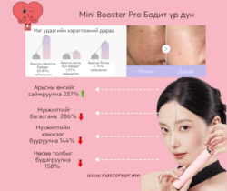 Age r booster pro mini