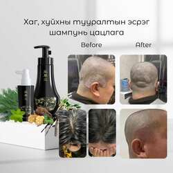 Хагны эсрэг шампунь цацлага