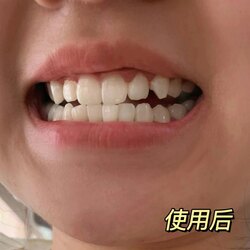 Шүд цайруулагч наалт