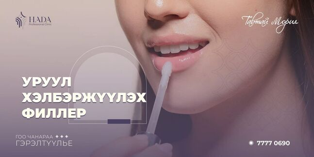 Уруул хэлбэржүүлэх филлер