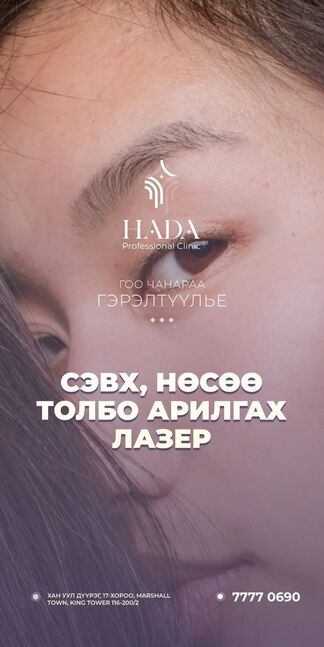 Сэвх нөсөө арилгах лазер
