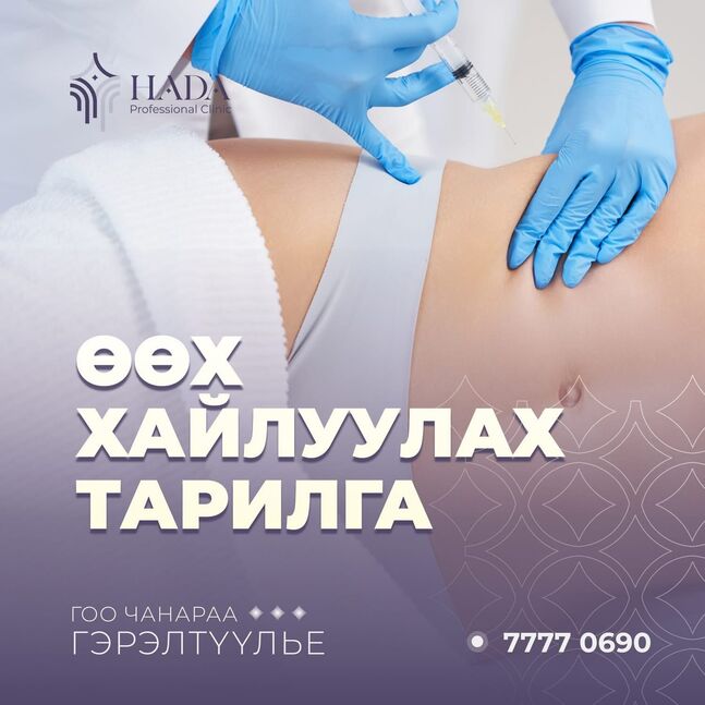 Өөх хайлуулах тарилга