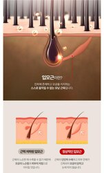 Volexy scalp shot pro