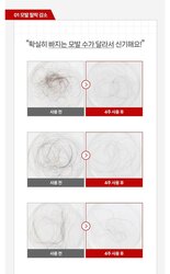 Volexy scalp shot pro