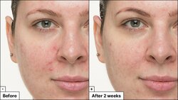 Dr.jart sleeping mask