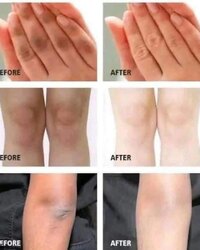 Glycolic acid 7% toning solution