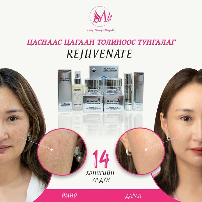 Rejuvenate залуужуулах иж бүрдэл