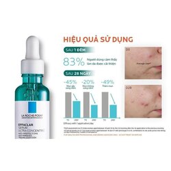 🇫🇷 la roche-posay effaclar