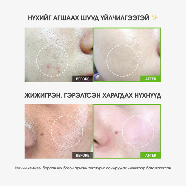 Sungboon Editor Green Tomato Pore Lifting Ampoule+ 30ml