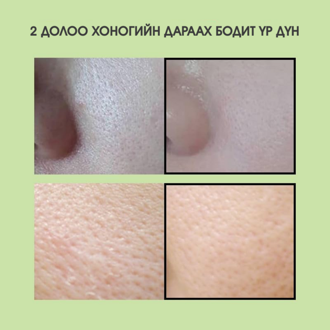 Sungboon Editor Green Tomato Pore Lifting Ampoule+ 30ml