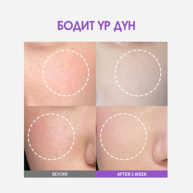 Sungboon Editor Meoru Podo VitaC Dark Spot Ampoule