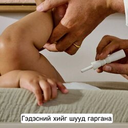 Windi гэдэсний хий гаргах гуурс