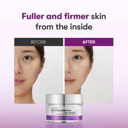 Reedle shot lifting cream