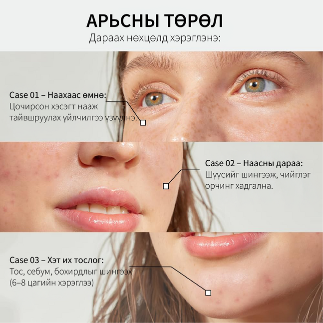 Parnell Cicamanu Clear Patch (Multi+)