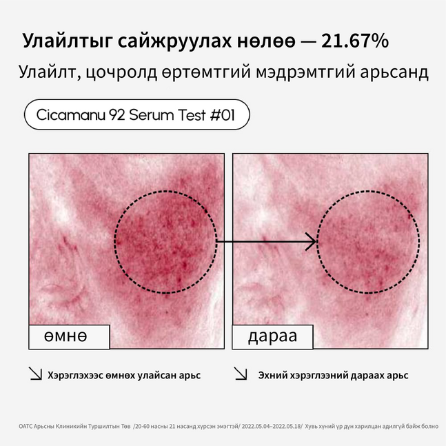 Parnell Cicamanu 92 сэрүм