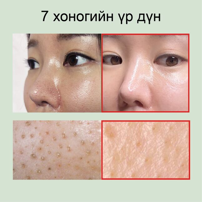 Mommy care Sea Grape Cleansing Oil