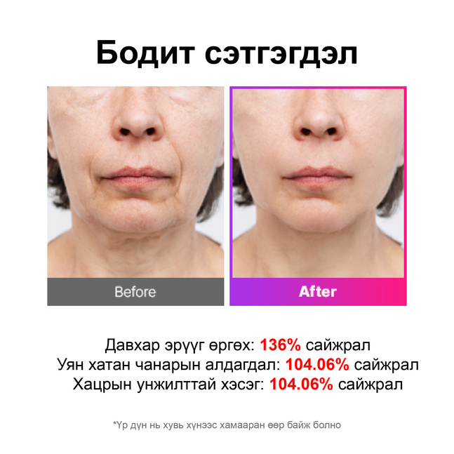 Mommy care EMS V-THERA