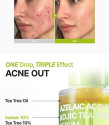 Purito azelaic serum