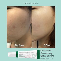 Dark spot glow serum