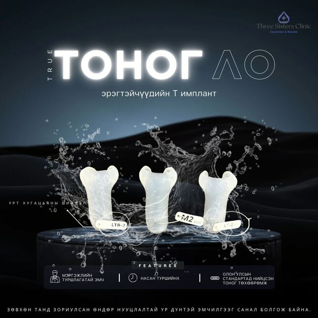 Эрэгтэйчүүдийн т имплант 