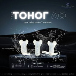 Эрэгтэйчүүдийн т имплант