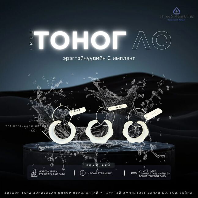 Эрэгтэйчүүдийн с имплант