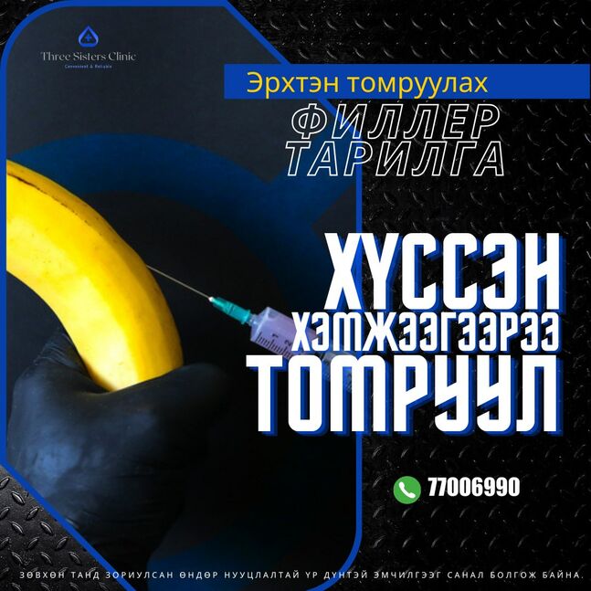 Эрэгтэйчүүдийн филлер тарилга