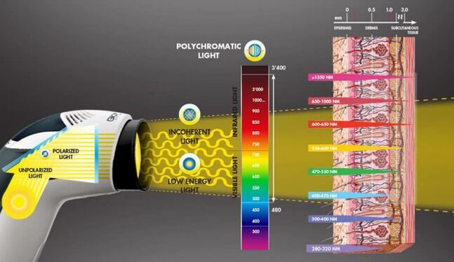 Bioptron шарлага эмчилгээ