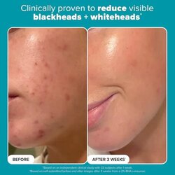 Paula’s choice - bha 118ml