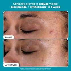 Paula’s choice - bha 118ml