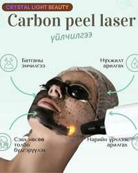 Carbon peel laser 