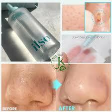 Батга хайлуулагч, зөөлрүүлэгч 