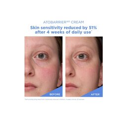 Aestura - atobarrier 365 cream