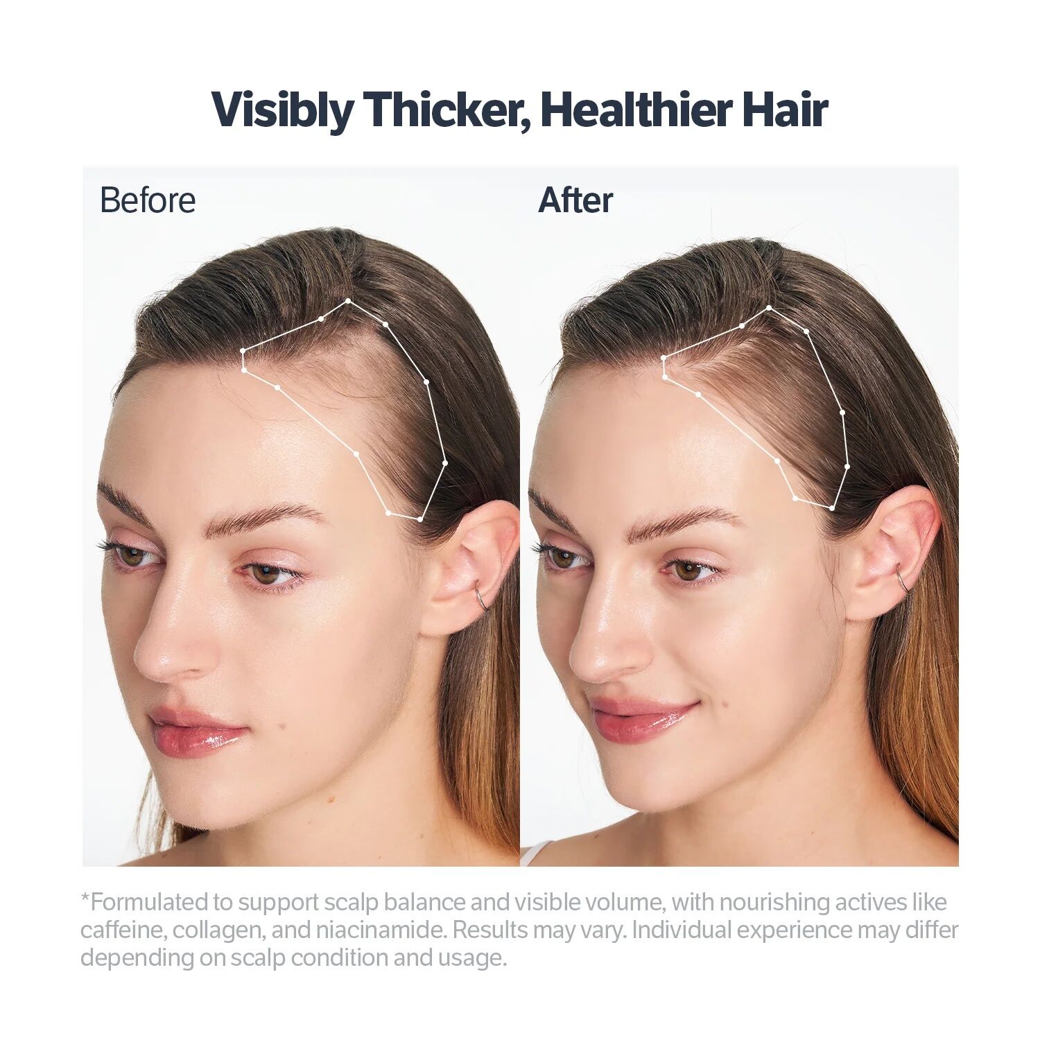 Sungboon Editor Deep Collagen Retinol Power Boosting Scalp Serum