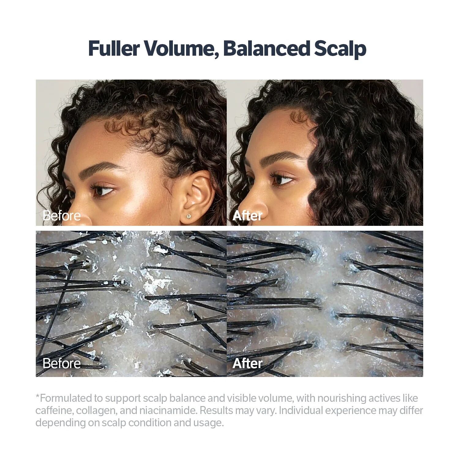 Sungboon Editor Deep Collagen Retinol Power Boosting Scalp Serum