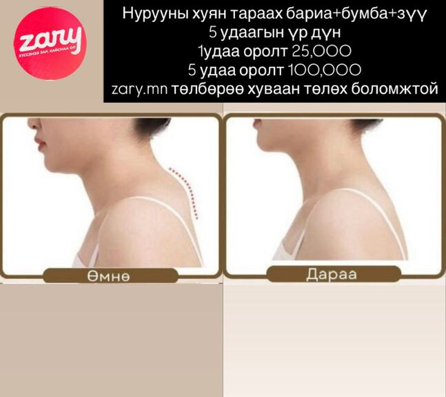 Хуян арилгах багц эмчилгээ