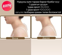 Хуян арилгах багц эмчилгээ