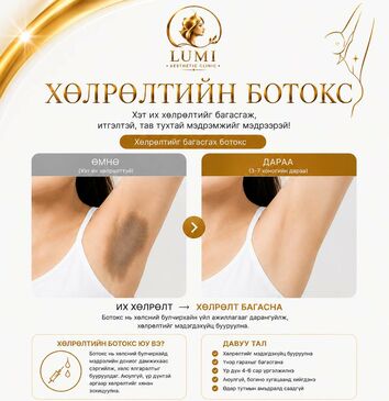 Суганы буюу хөлрөлтийн ботокс