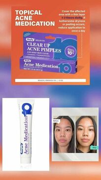 Rugby Acne Medication Benzoyl Peroxide Gel 10